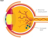 Bevacizumab VEGF Lucentis V21D02MN