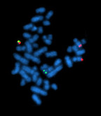 CML Bcrablmet V17A13