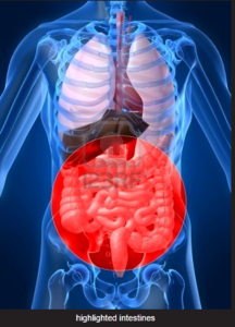 IBD 3 IBD 3