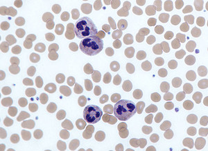 Neutrophils V14J31.jpg