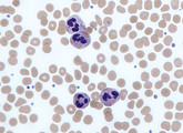 Neutrophils V14J31